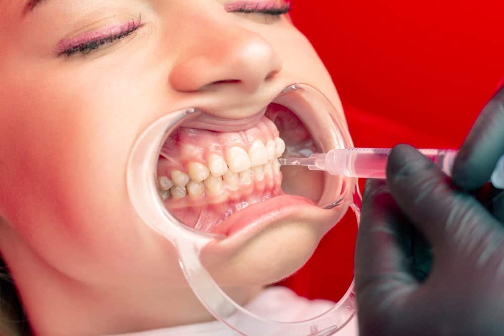 תביעת רשלנות רפואית ברפואת שיניים 2