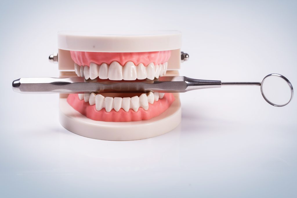 רשלנות רפואית בטיפולי שיניים